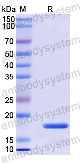 Recombinant Human RGS14 Protein, N-His