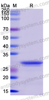 Recombinant Human DCX Protein, N-His-SUMO & C-Strep