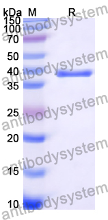 Recombinant Human GALR2 Protein, N-GST & C-His