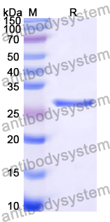 Recombinant Human TIMM44 Protein, N-His