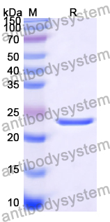 Recombinant Human NCK2 Protein, N-His