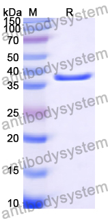 Recombinant Human PLRG1 Protein, N-His