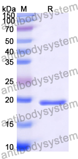 Recombinant Human LDB2 Protein, N-His