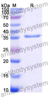 Recombinant Human SULT1B1 Protein, N-His