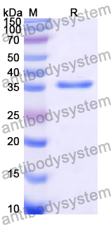 Recombinant Human TRIAP1 Protein, N-GST & C-His