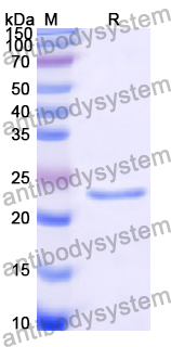 SDS-PAGE for Recombinant Human CHP2 Protein, N-His ?>