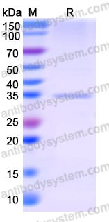 Recombinant Human SGTA Protein, N-His-SUMO & C-Strep