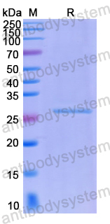 Recombinant Human LIAS Protein, N-His