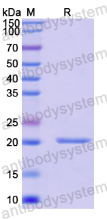 Recombinant Human SPOP Protein, N-His