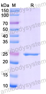 Recombinant Human AIRE Protein, N-His-SUMO