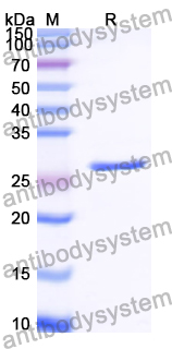 SDS-PAGE for Recombinant Human ADCY3 Protein, N-His ?>