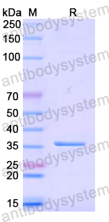 Recombinant Human NUAK1 Protein, N-His