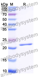 SDS-PAGE for Recombinant Human ATP10A Protein, N-His ?>