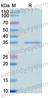 Recombinant Human ZEB2 Protein, N-GST & C-His