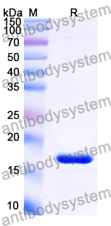 Recombinant Human NOBOX Protein, N-His