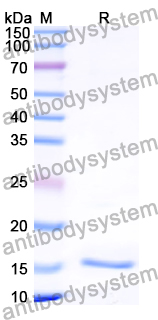 Recombinant Human FADS1/Delta 5 desaturase Protein, N-His