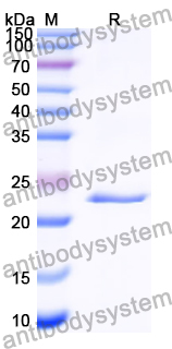 Recombinant Human ZIC3 Protein, N-His