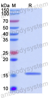 Recombinant Human MPZL2 Protein, N-His