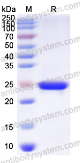 Recombinant Human ACSL4 Protein, N-His