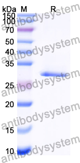 Recombinant Human DOK2 Protein, N-His