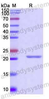 Recombinant Human CIDEA Protein, N-His-SUMO & C-Strep