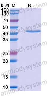 Recombinant Human GMDS Protein, N-His