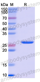 Recombinant Human PLOD3 Protein, N-His