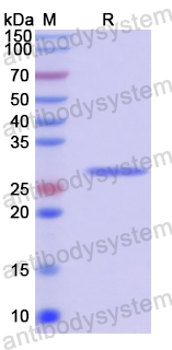 Recombinant Human EXOC3 Protein, N-His