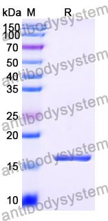 Recombinant Human LMX1B Protein, N-His
