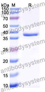 Recombinant Human PRMT3 Protein, N-His