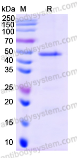 Recombinant Human SRPX2 Protein, N-His