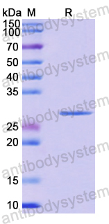 Recombinant Human CTNND1 Protein, N-His