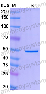 Recombinant Human PFKFB2 Protein, N-His