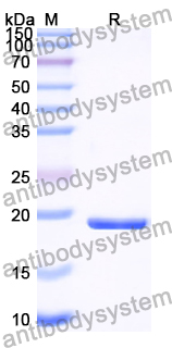 Recombinant Human TRIM13 Protein, N-His