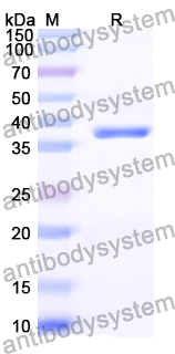 Recombinant Human SH2D1A Protein, N-GST & C-His
