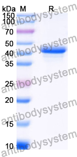 Recombinant Human DNAJA2 Protein, N-His