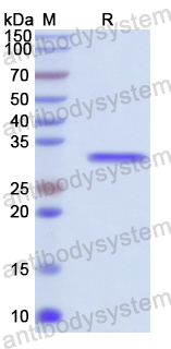 Recombinant Human HUS1 Protein, N-His