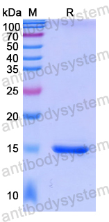 Recombinant Human NBN Protein, N-His