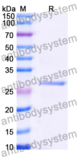 Recombinant Human RNGTT Protein, N-His