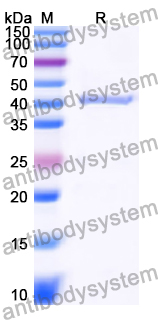 Recombinant Human FAM20B Protein, N-His