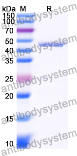 Recombinant Human ADAM23 Protein, N-His