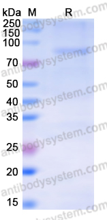 Recombinant Human WDR1 Protein, N-GST & C-His