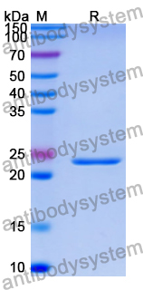 Recombinant Human N4BP1 Protein, N-His