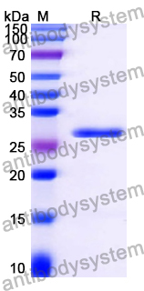 Recombinant Human CD168/HMMR Protein, N-His