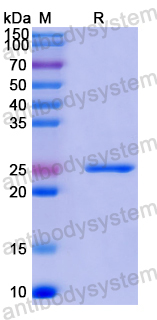 Recombinant Human TBCA Protein, N-His-SUMO