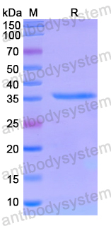Recombinant Human VPS4B Protein, N-His