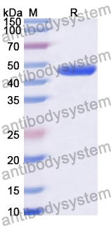 Recombinant Human ENTPD5 Protein, N-His