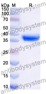 Recombinant Human PROP1 Protein, N-GST & C-His