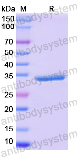 Recombinant Human TULP3 Protein, N-His