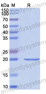 Recombinant Human SEC22B Protein, N-His